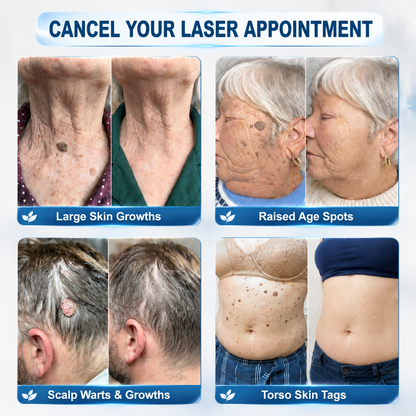 7-Day Skin Tag & Spot Eraser